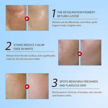 Medicirana Pigment Zdravilnimi Kreme za Beljenje Vlažilec Pege nego Freckle Chloasma Odstranitev Nova